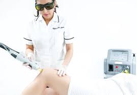 laser hair removal