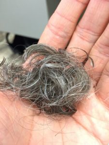 grey hair falling of