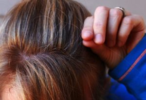 young age hair greying
